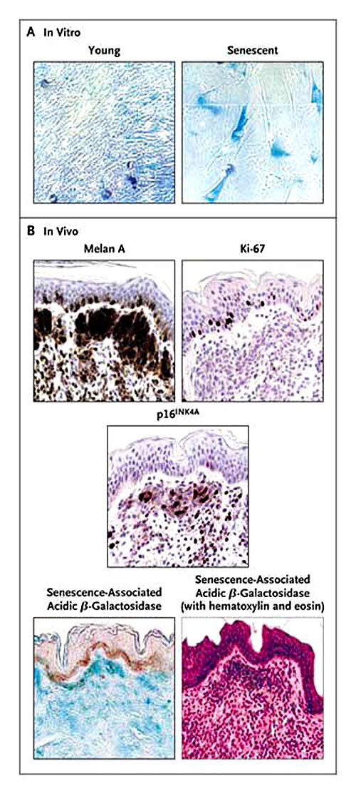 Figura 2: envejecimiento in vitro e in vivo