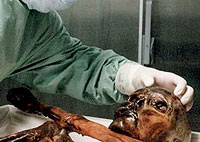 Expertos austriacos e italianos lograron <br>determinar las verdaderas causas de la<br>muerte de Ötzi