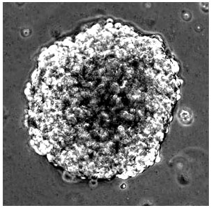 Figura 4: neuroesfera primaria humana