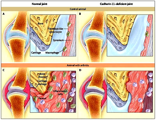 Figura 1: caderina-11 e inflamación