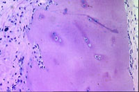 Microfotografía optica: fragmento de<br>tejido cartilaginoso articular humano<br>crioconservado un año a - 196 ºC<br>e implantado postdescongelación<br>durante 70 días<br>Foto gentileza Dr. Sergio Tapia