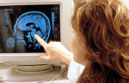 El cerebro responde primero a situaciones de recompensa y después al riesgo