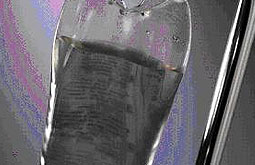 IGIV tiene elevada incidencia de efectos adversos en pacientes pediátricos