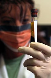 Pruebas sólidas de que el VHH-8 se transmite por transfusión sanguínea