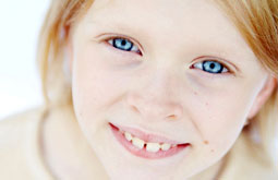 Rivoflavina/UVA estabiliza el queratocono en pediatría