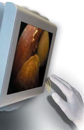 Videojuegos mejoran la habilidad quirúrgica de los cirujanos