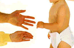 El DRIFT no previene la hidrocefalia en recién nacidos de pretérmino