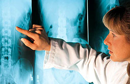 Manejo quirúrgico de la espondilolistesis es superior al abordaje conservador