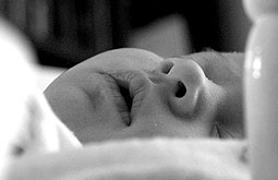 Profilaxis con fluconazol reduce candidiasis invasiva en prematuros