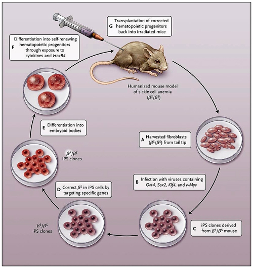 Figura 1: curación de la anemia drepanocítica en un modelo de ratón humanizado