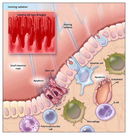 Figura 1: efectos tóxicos de la radiación en el intestino