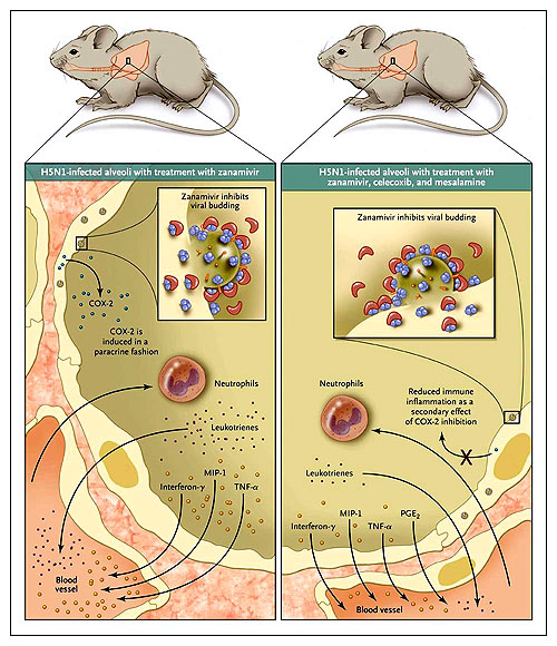 Figura 1: respuesta inflamatoria a la infección por influenza