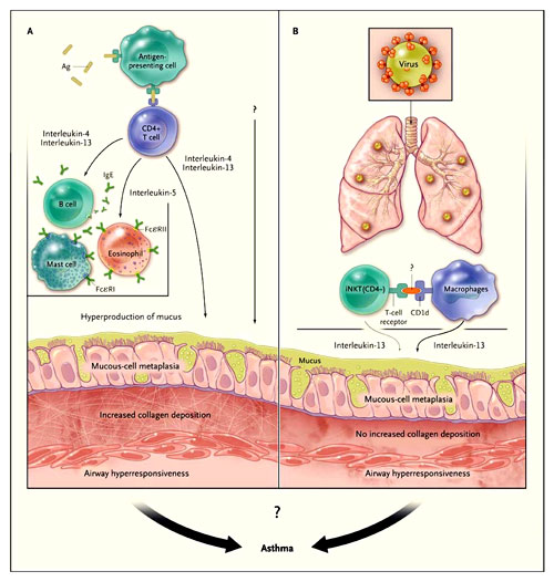 Figura 1: dos modelos de enfermedad crónica de las vías respiratorias