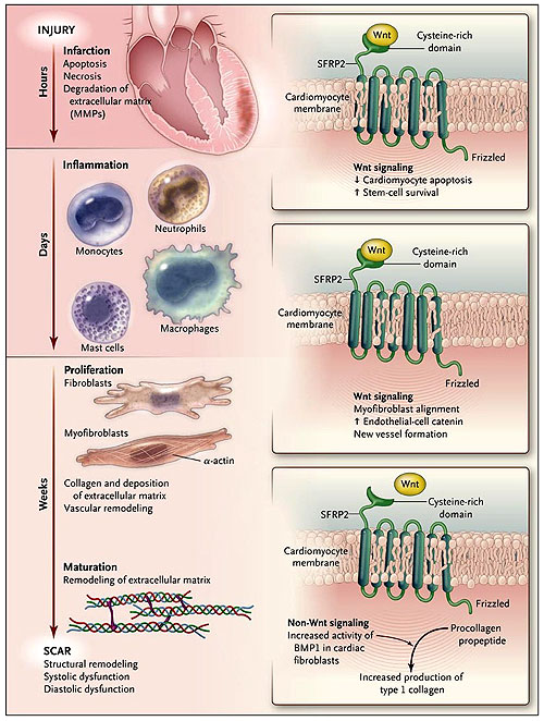 Figura 1: proteína 2 secretada relacionada a frizzled (SFRP2) y el infarto de miocardio