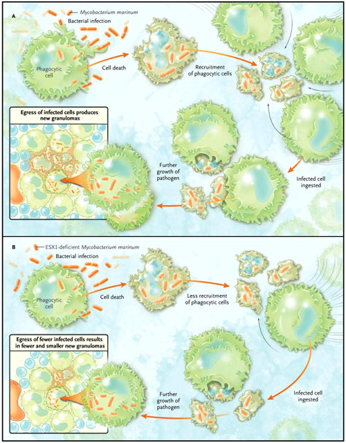 Figura 1: <em>Mycobacterium</em> y macrófagos