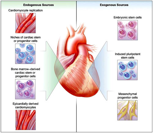 Figura 1: enfoques terapéuticos para la regeneración cardíaca