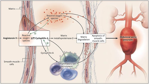 Figura 1: ciclofilina A y aneurismas aórticos abdominales