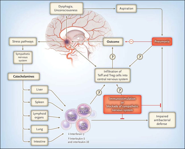 Figura 1: accidente cerebrovascular y activación de las células T asesinas naturales invariantes (NK) 