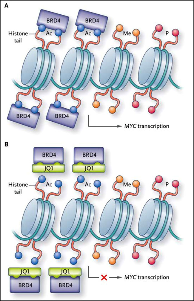 Figura 1: evitando la transcripción MYC en leucemia mieloide aguda