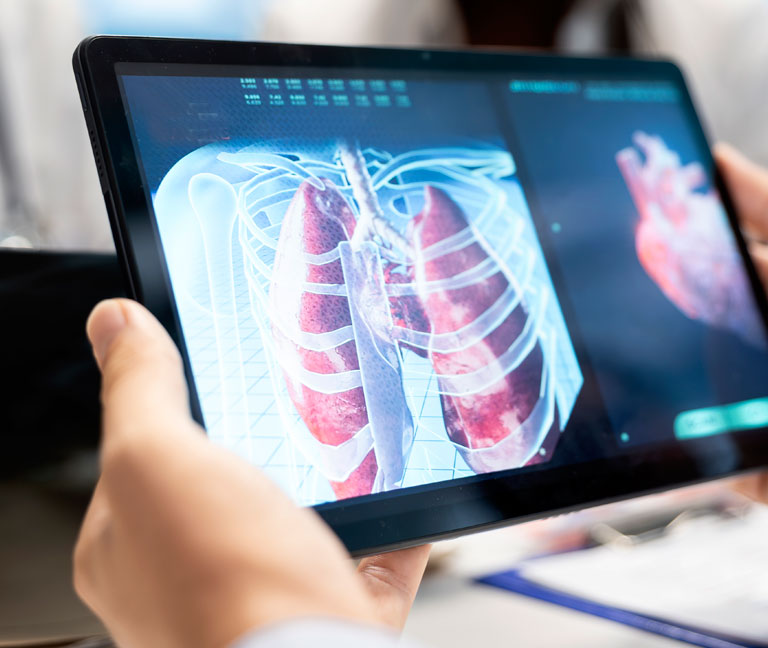 SER Chile actualiza el manejo de patologías respiratorias