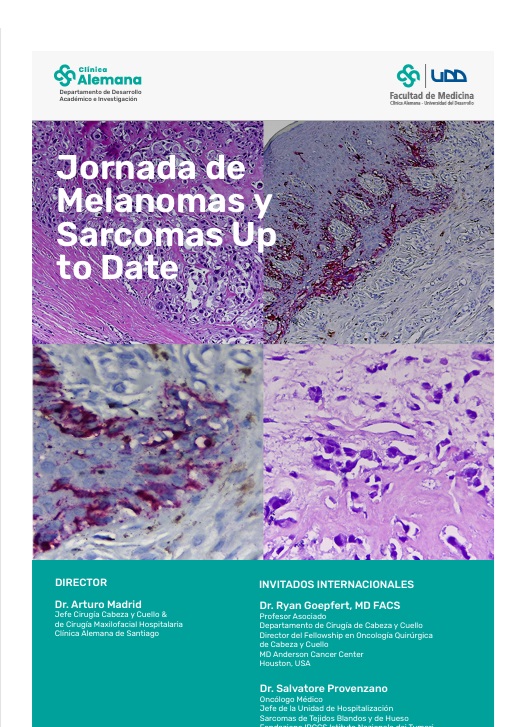 Jornada de Melanomas y Sarcomas Up to Date