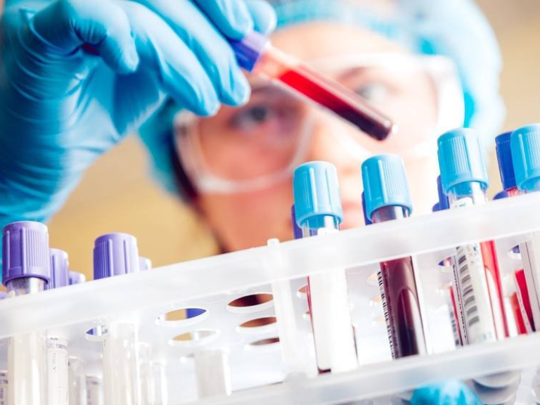 Clínica Mayo, Mayo Clinic, cáncer testicular, detección de cáncer testicular, diagnóstico de cáncer testicular, marcadores tumorales, análisis de sangre, tumores de células germinales, GCT-iSIGN, Sem-iSIGN, biomarcadores sanguíneos, sistema inmunitario, detección temprana del cáncer, diagnóstico precoz, investigación médica, estudio científico, oncología, cáncer en adolescentes, cáncer en adultos jóvenes, pruebas diagnósticas, medicina de precisión, diagnóstico oncológico, tratamiento del cáncer testicular, Divyanshu Dubey, Dr. Divyanshu Dubey, profesor de neurología, investigación en cáncer, biomarcadores inmunológicos, innovación médica, salud masculina, tumores testiculares, detección temprana, avances en oncología, medicina traslacional