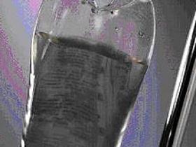 IGIV tiene elevada incidencia de efectos adversos en pacientes pediátricos