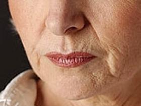 Personas con reflujo gastroesofágico enfrentan mayor peligro de cáncer de laringe