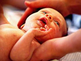 Prematuros tienen más posibilidades de sufrir hemangiomas