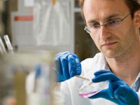 ProteÃna Angptl2 en obesos causa diabetes e inflamación