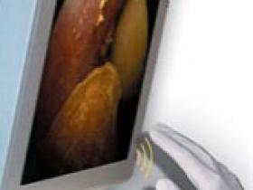 Videojuegos mejoran la habilidad quirúrgica de los cirujanos