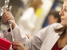 EPCA-2 es un efectivo biomarcador asociado al cáncer de próstata