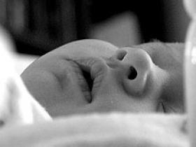 Profilaxis con fluconazol reduce candidiasis invasiva en prematuros