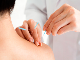 Acupuntura en dolor musculoesquelético crónico oncológico