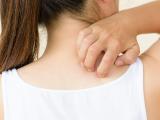 Difelikefalina para la notalgia parestésica