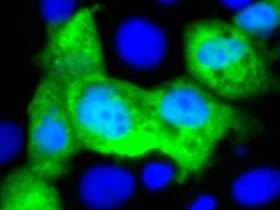 Anticuerpos neutralizantes mucosos y sistémicos contra norovirus