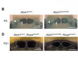 Atoh1 reduce la heterogeneidad de las neuronas pontinentes y favorece su diferenciación