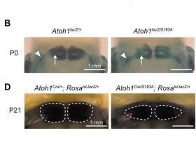 Atoh1 reduce la heterogeneidad de las neuronas pontinentes y favorece su diferenciación