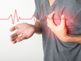 Monoterapia anticoagulante tras un dispositivo de asistencia ventricular