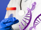 ARN de heces como biomarcador para el cáncer de colon