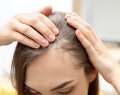 salud capilar, vitamina d, hierro, alopecia, perdida de cabello, encanecimiento prematuro 