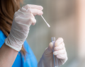 virus del papiloma humano, VPH, cribado del VPH, detección del VPH, autotoma de muestra vaginal, cáncer cervicouterino, tamizaje de cáncer cervicouterino