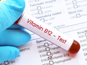 deficiencia de vitamina B12, hipovitaminosis B12, neuropatía periférica, metformina, uso crónico de metformina, uso de metformina a largo plazo, diabetes tipo 2