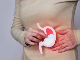 dispepsia funcional, trastornos de la interacción intestino-cerebro, tratamiento de la dispepsia funcional, diagnóstico de la dispepsia funcional, síntomas de la dispepsia funcional, antiácidos, simeticona