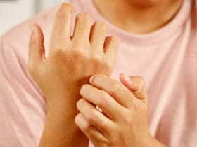 dermatitis atópica, tratamiento de la dermatitis atópica, terapia coadyuvante en dermatitis atópica, prurito atópico, antihistamínicos H1 orales