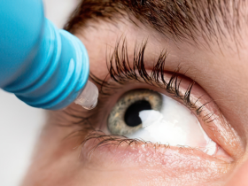 glaucoma, glaucoma primario de ángulo abierto, terapia triple en glaucoma, ceguera, presión intraocular, combinación triple fija libre de conservantes, timolol, dorzolamida, brimonidina