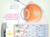 optogenética, terapia optogenética directa, retinitis pigmentosa, ceguera, ceguera avanzada