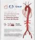 cardiología, sochicar, disección aórtica, capacitación