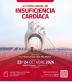 sochicar, insuficiencia cardíaca, capacitación