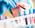 Clínica Mayo, Mayo Clinic, cáncer testicular, detección de cáncer testicular, diagnóstico de cáncer testicular, marcadores tumorales, análisis de sangre, tumores de células germinales, GCT-iSIGN, Sem-iSIGN, biomarcadores sanguíneos, sistema inmunitario, detección temprana del cáncer, diagnóstico precoz, investigación médica, estudio científico, oncología, cáncer en adolescentes, cáncer en adultos jóvenes, pruebas diagnósticas, medicina de precisión, diagnóstico oncológico, tratamiento del cáncer testicular, Divyanshu Dubey, Dr. Divyanshu Dubey, profesor de neurología, investigación en cáncer, biomarcadores inmunológicos, innovación médica, salud masculina, tumores testiculares, detección temprana, avances en oncología, medicina traslacional